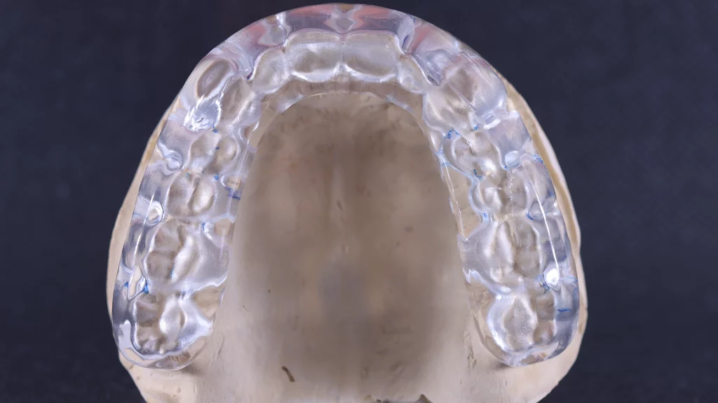 FerulasdeDescara_Servicios_3