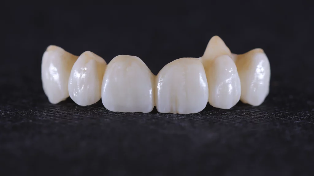 ProtesisFijas_Servicios