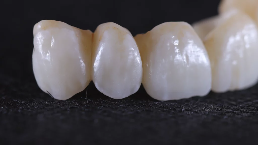 ProtesisFijas_Servicios_1