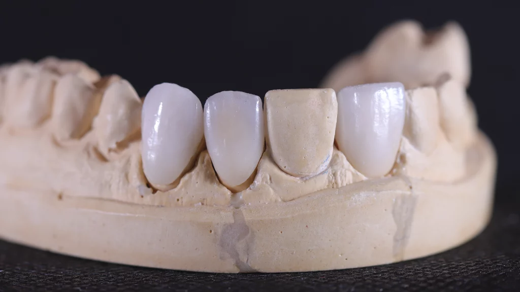 ProtesisFijas_Servicios_12