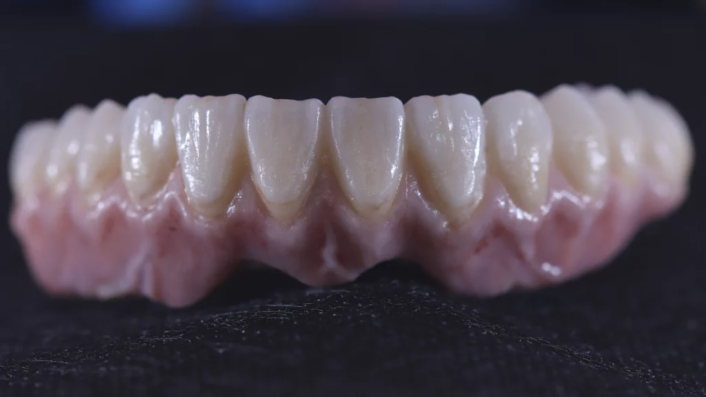 ProtesisFijas_Servicios_2