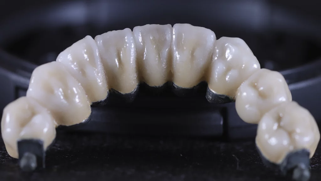 ProtesisFijas_Servicios_23_metalceramica