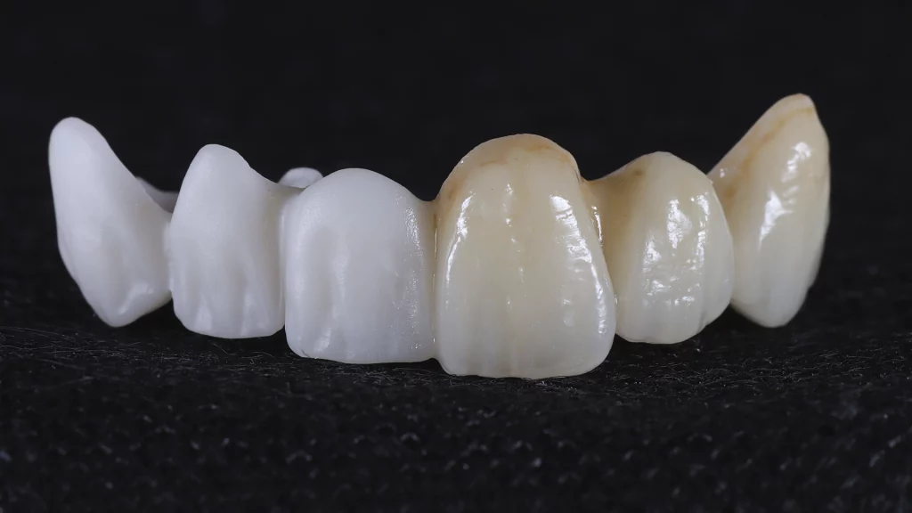 ProtesisFijas_Servicios_6