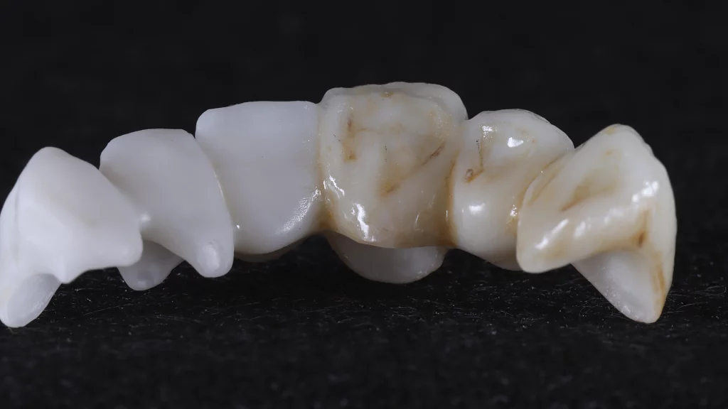 ProtesisFijas_Servicios_7