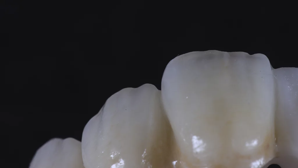 ProtesisFijas_Servicios_8