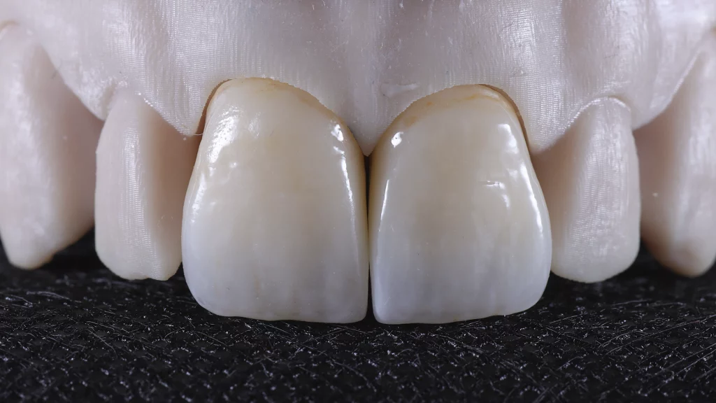 ProtesisFijas_Servicios_9