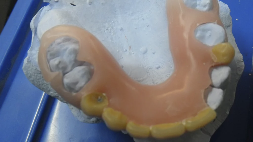 Protesis_Flexibles_Servicios