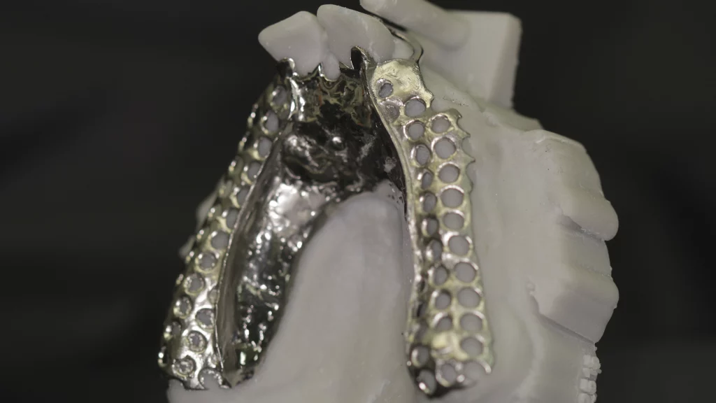 esqueleticos_Servicios_1