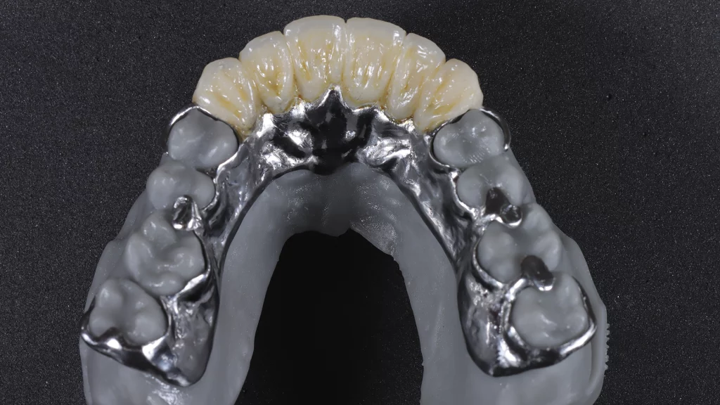 esqueleticos_Servicios_6