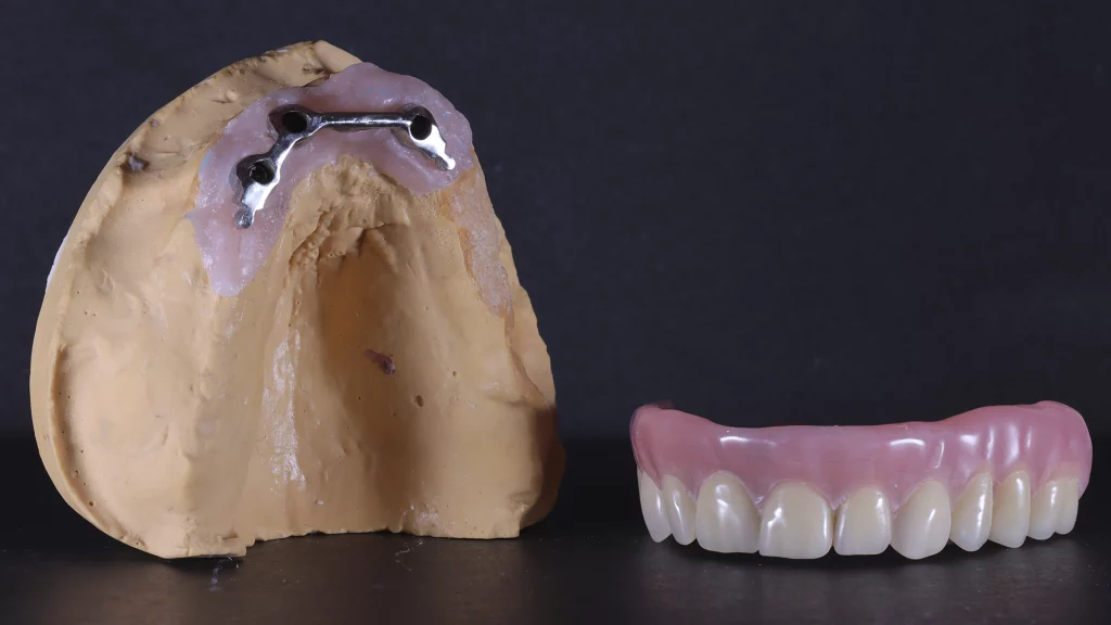 protesis_implantes_Servicios