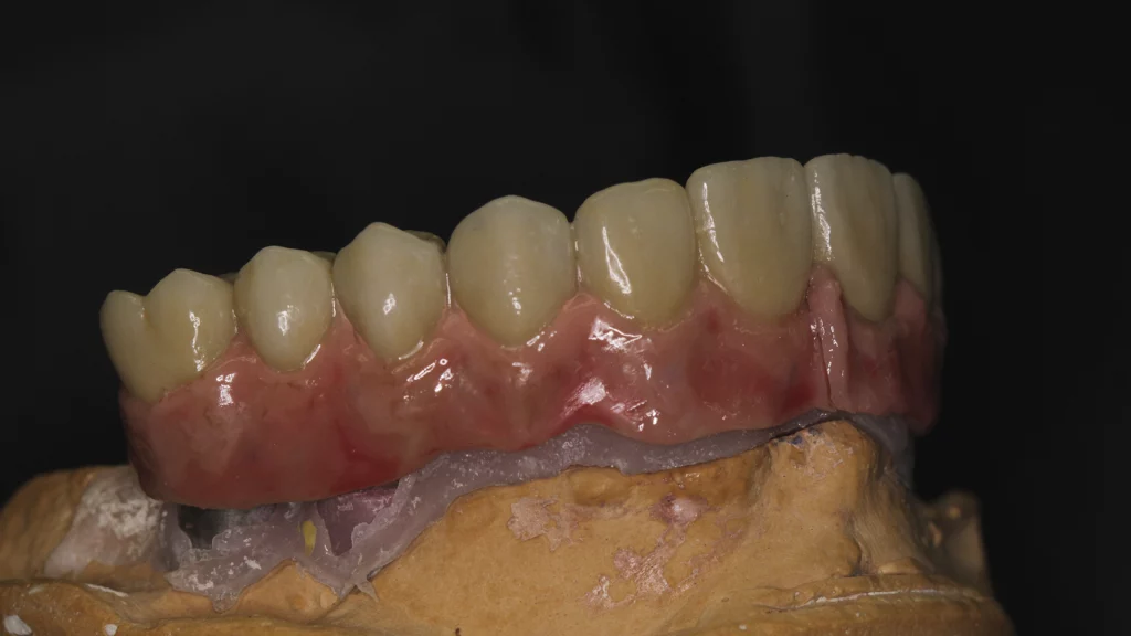 protesis_implantes_Servicios_1