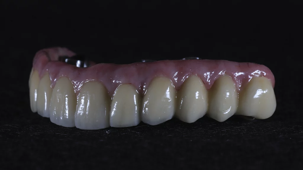 protesis_implantes_Servicios_10