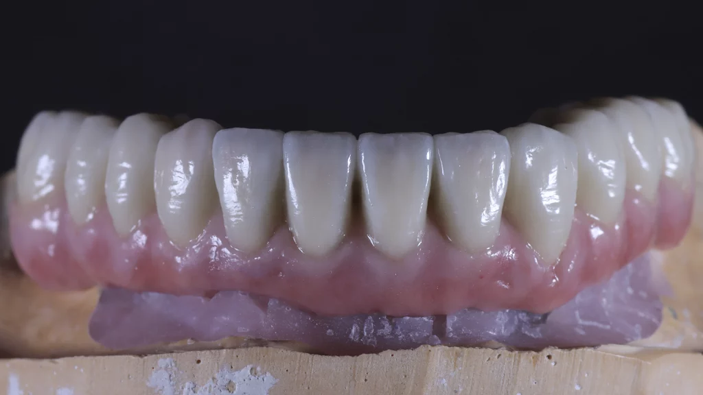 protesis_implantes_Servicios_11