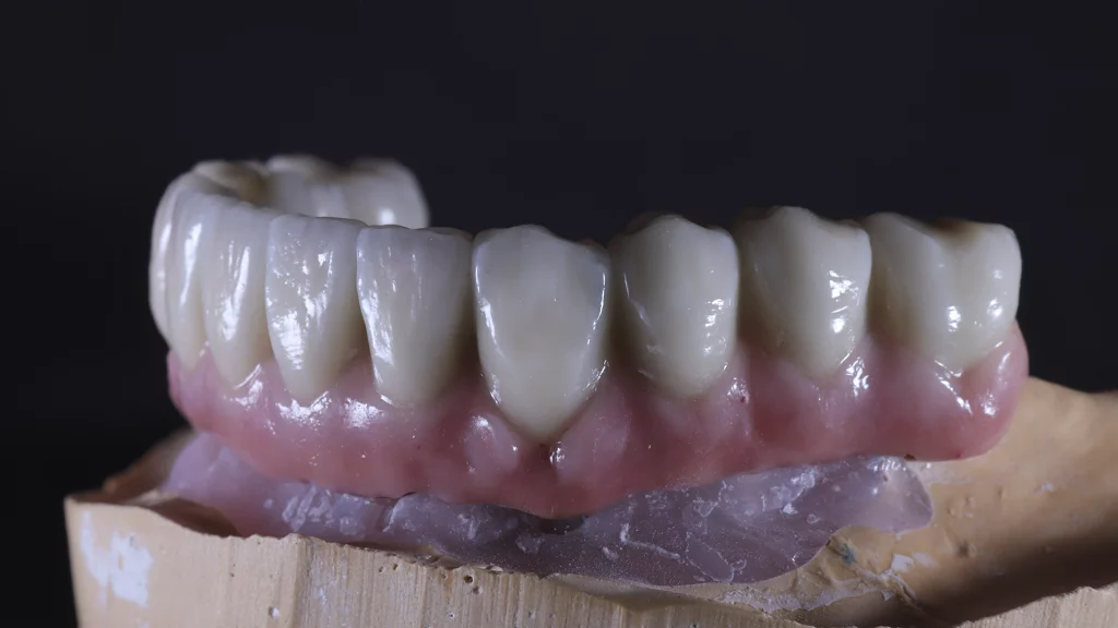 protesis_implantes_Servicios_13