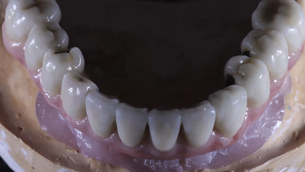 protesis_implantes_Servicios_14