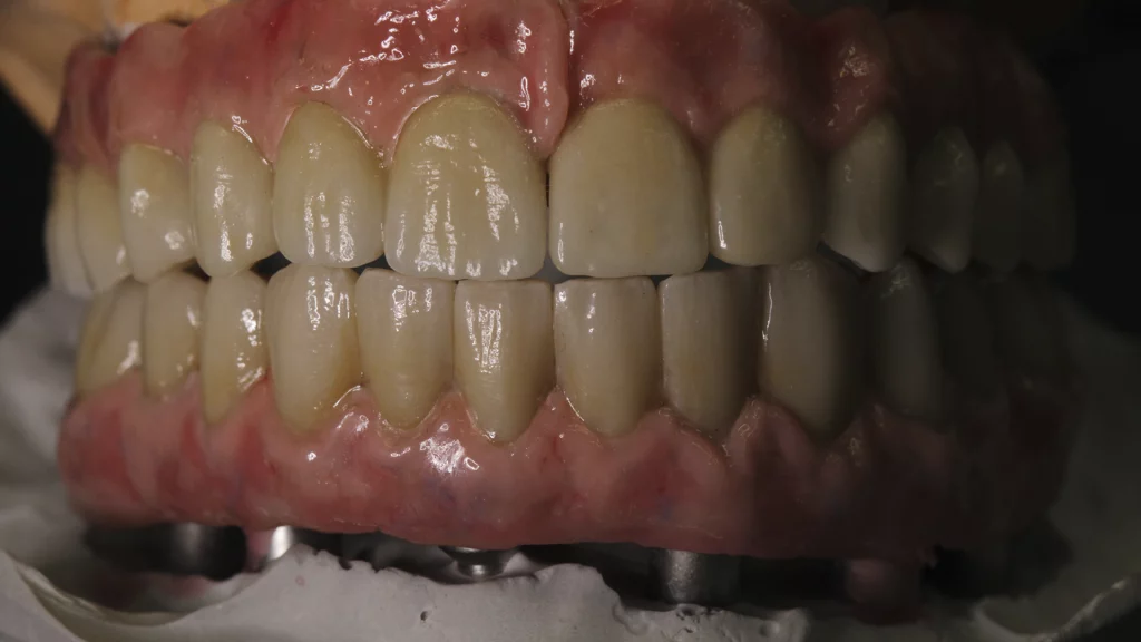 protesis_implantes_Servicios_2