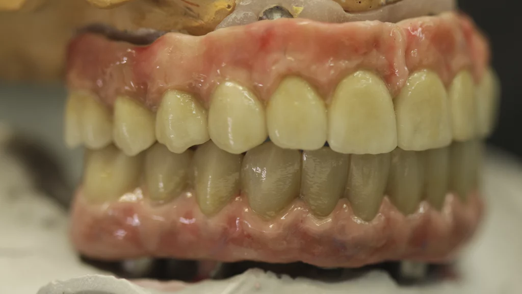 protesis_implantes_Servicios_3