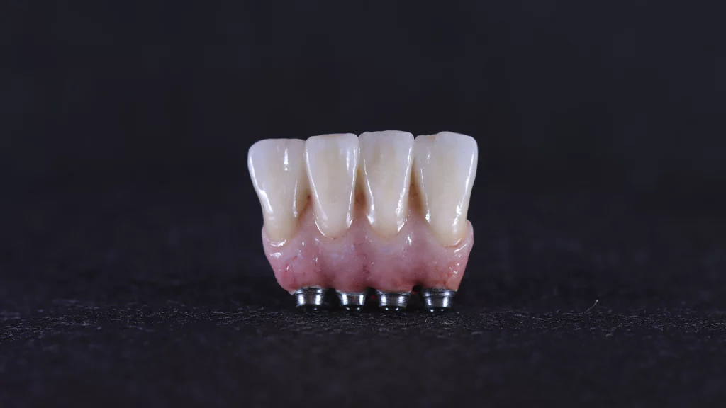 protesis_implantes_Servicios_5