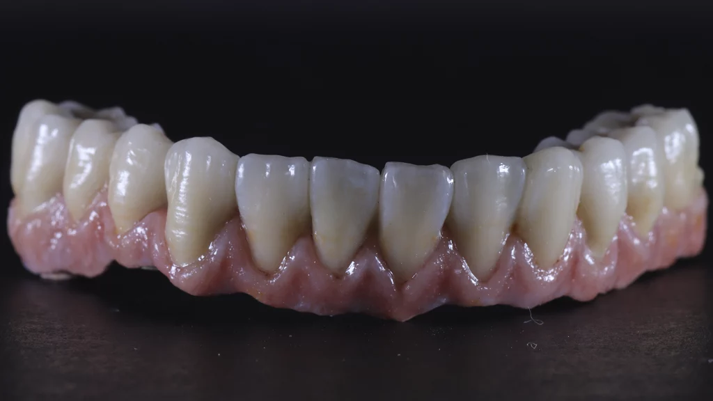 protesis_implantes_Servicios_6