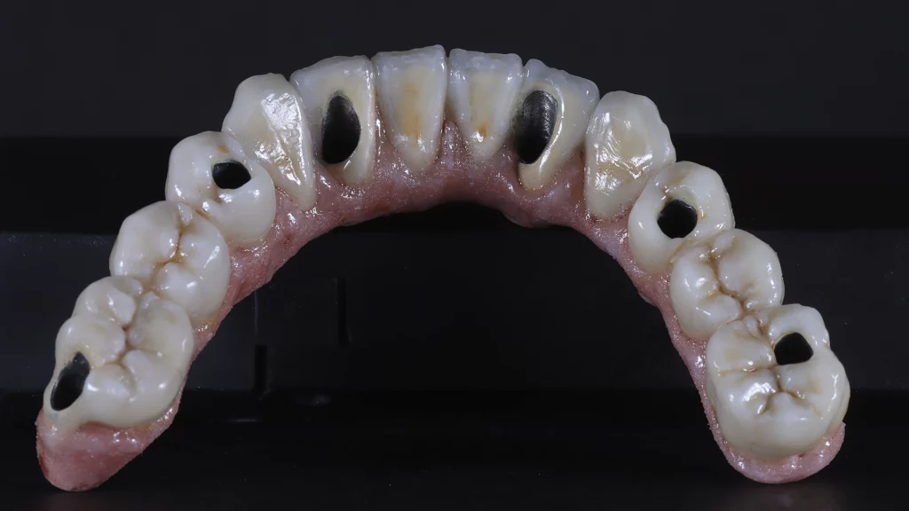 protesis_implantes_Servicios_7