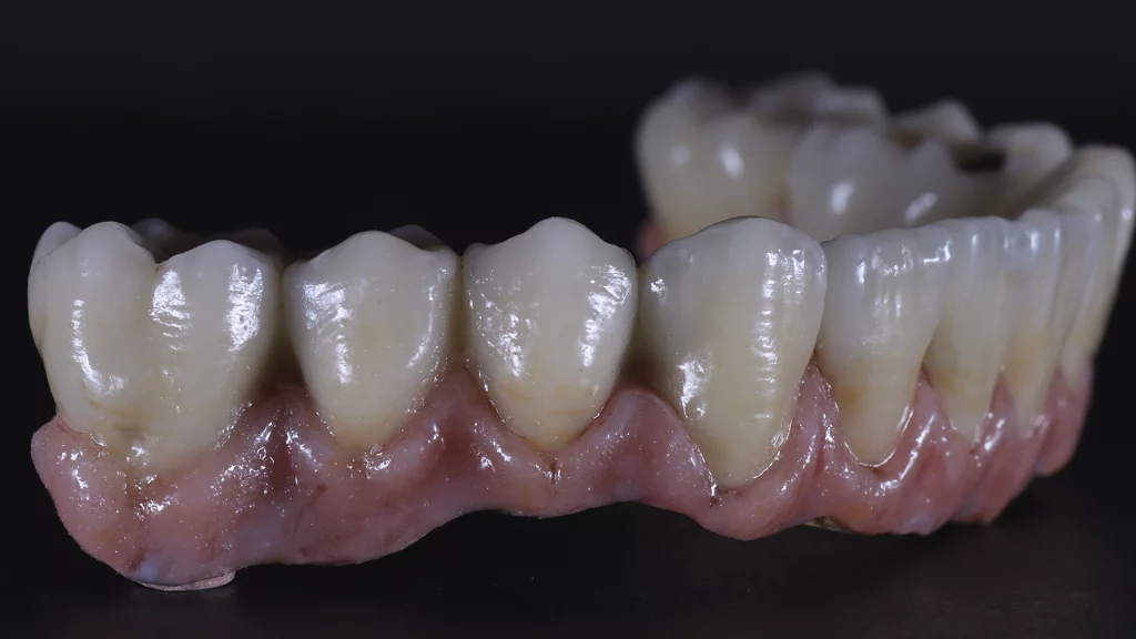 protesis_implantes_Servicios_8