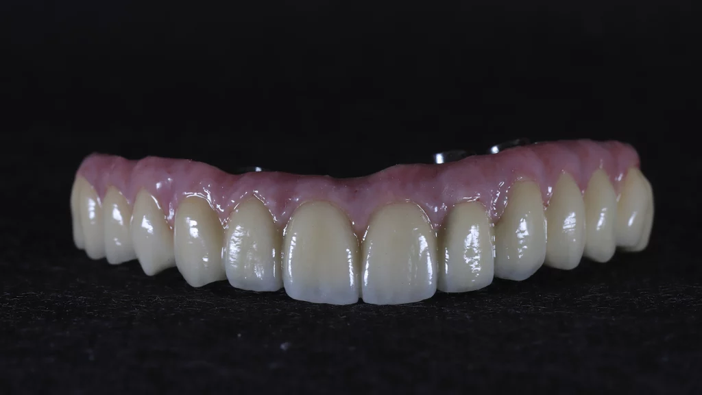 protesis_implantes_Servicios_9