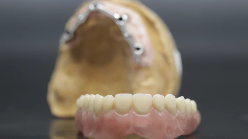 protesis_removibles_Servicios