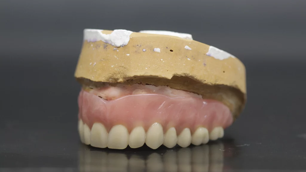 protesis_removibles_Servicios_1