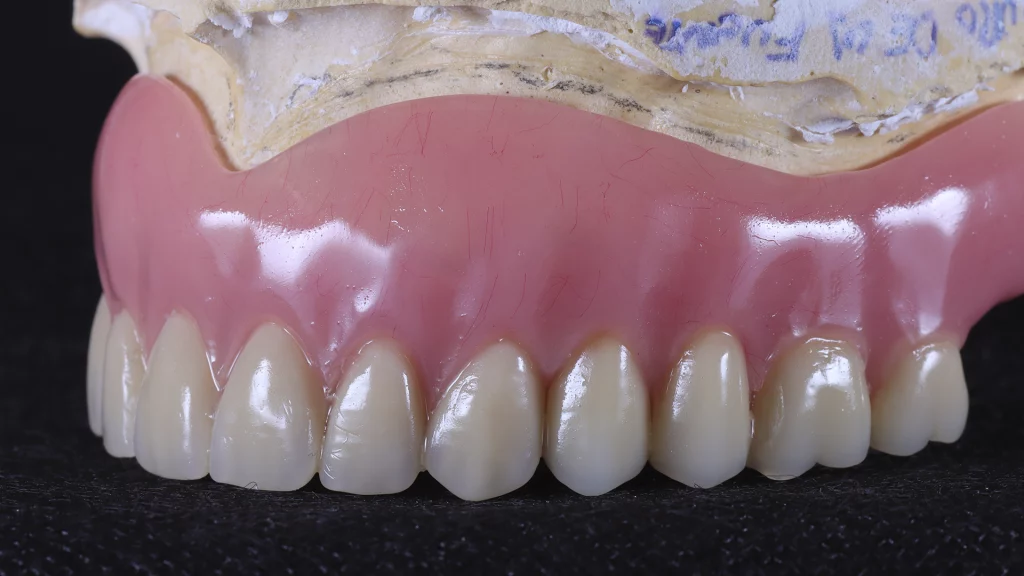 protesis_removibles_Servicios_2