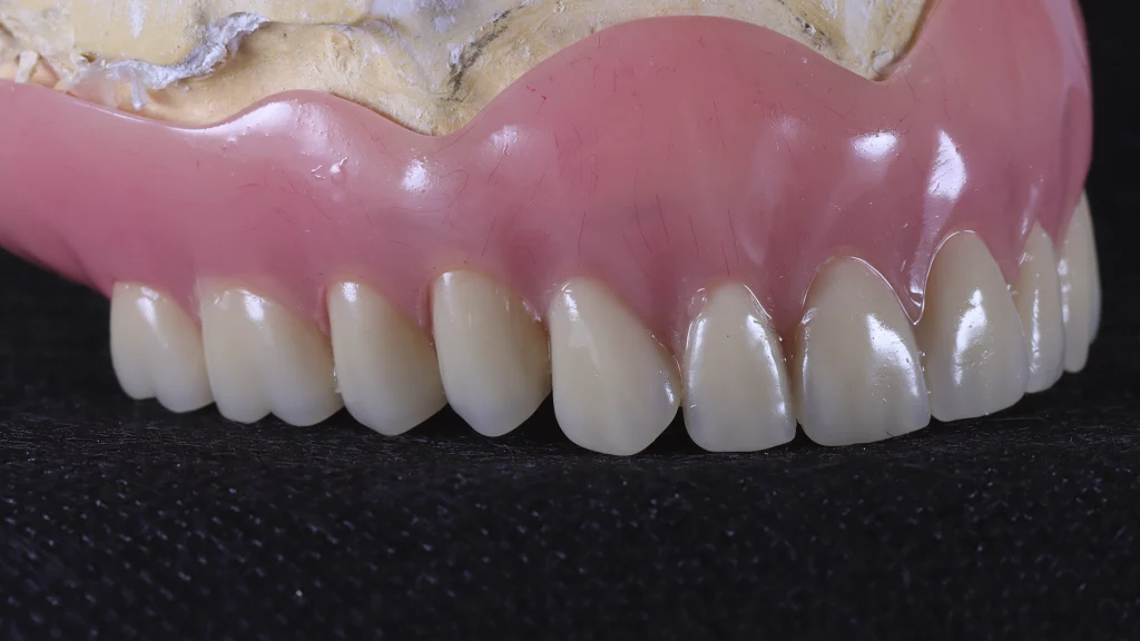 protesis_removibles_Servicios_3