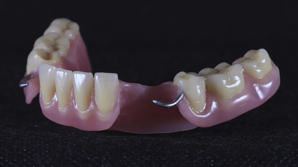 protesis_removibles_Servicios_4