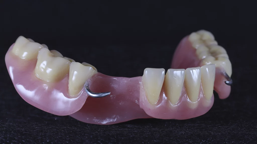 protesis_removibles_Servicios_5